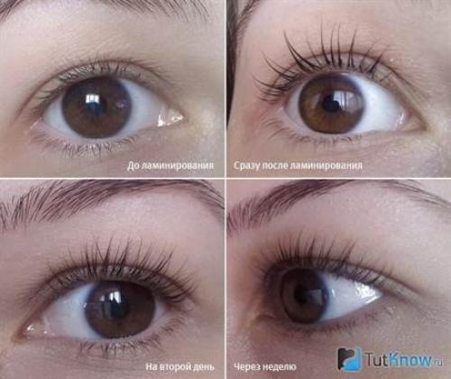 Можно ли делать ламинирование ресниц при беременности. Беременность и ламинирование ресниц: что это такое и можно ли ее делать в период гистации 02