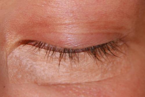 Могут ли вырасти ресницы. Вырастут ли ресницы после наращивания