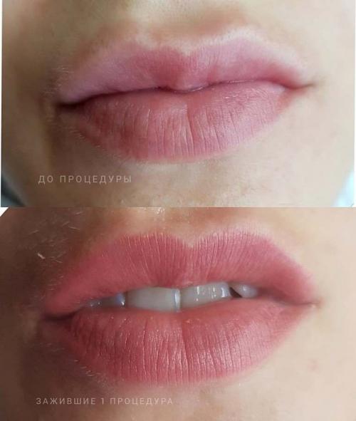 Сколько длится татуаж губ. Сколько заживает татуаж губ?