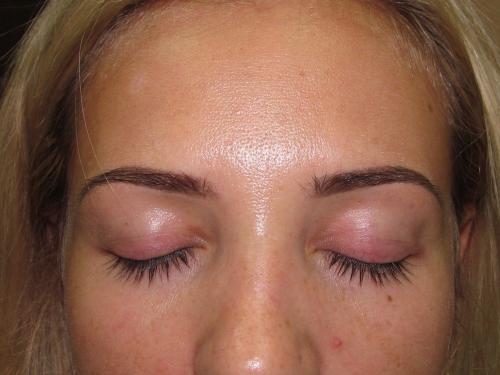 Заживление Бровей после татуажа. Первые дни после перманентного татуажа 07 Заживление Бровей после татуажа. Первые дни после перманентного татуажа 07