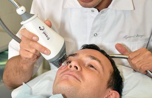 Щетина после лазерной эпиляции. Что это такое