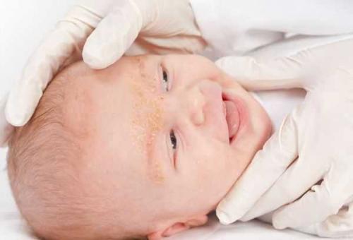 Почему под бровями шелушится кожа. Причины шелушения бровей 06 Почему под бровями шелушится кожа. Причины шелушения бровей 06