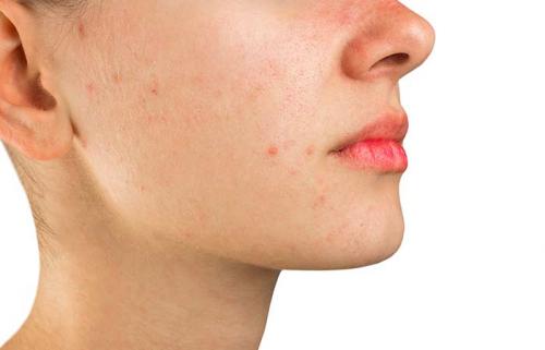 Как корректировать лицо корректорами. Как правильно пользоваться корректором для лица: пошаговая инструкция с фото