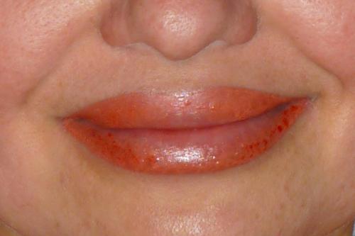 Делать татуаж губ или нет. Что же это за процедура такая — татуаж губ? 03 Делать татуаж губ или нет. Что же это за процедура такая — татуаж губ? 03