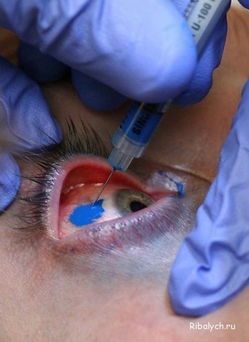 Больно ли делать стрелки татуаж. Больно ли делать перманентные стрелки, используется ли анестезия? 19 Больно ли делать стрелки татуаж. Больно ли делать перманентные стрелки, используется ли анестезия? 19