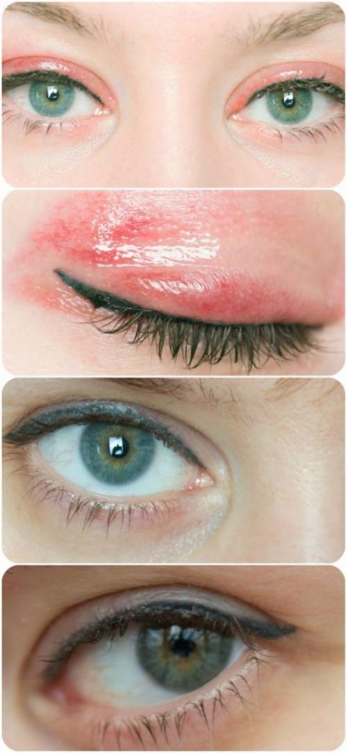 Можно ли умываться после татуажа век. Восстановление эпидермиса