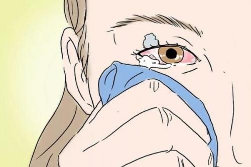 Что делать попал в глаз клей. Что делать в домашних условиях, если клей попал в глаза – экстренная помощь