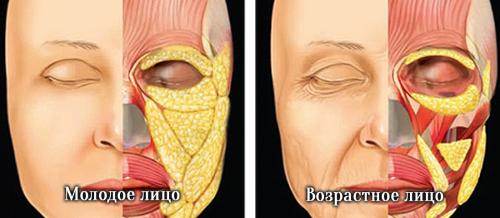 Темные круги под глазами признак, какой болезни. Возрастные изменения и темные круги под глазами