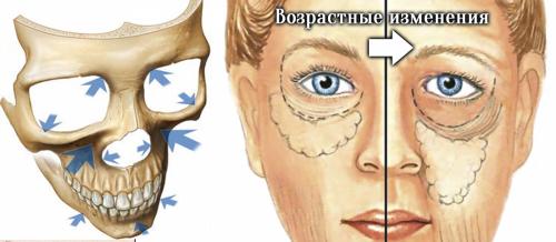 Темные круги под глазами признак, какой болезни. Возрастные изменения и темные круги под глазами