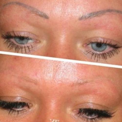 Что будет если не делать коррекцию татуажа бровей. Для чего нужна коррекция бровей после татуажа? 04