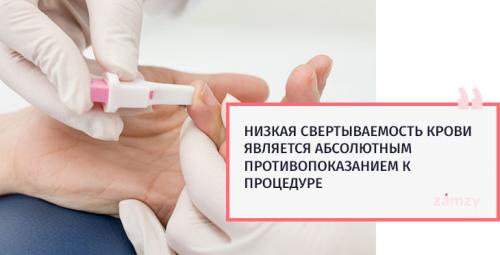 Минусы и плюсы татуажа бровей. 10 Минусы и плюсы татуажа бровей. 10