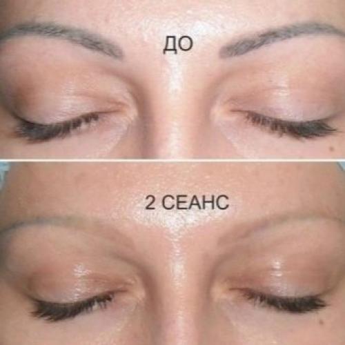 Что будет если не делать коррекцию татуажа бровей. Для чего нужна коррекция бровей после татуажа? 05