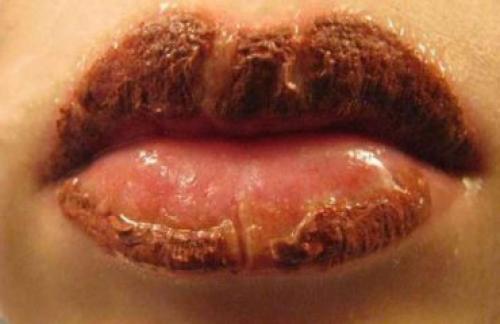 Кто пил алкоголь после татуажа. 