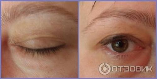 Снять отек после татуажа век. Как снять отек после татуажа 08 Снять отек после татуажа век. Как снять отек после татуажа 08