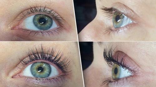 Можно ли делать беременным ламинирование ресниц. Можно ли делать процедуру во время беременности 04 Можно ли делать беременным ламинирование ресниц. Можно ли делать процедуру во время беременности 04