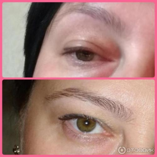 Снять отек после татуажа век. Как снять отек после татуажа 09 Снять отек после татуажа век. Как снять отек после татуажа 09