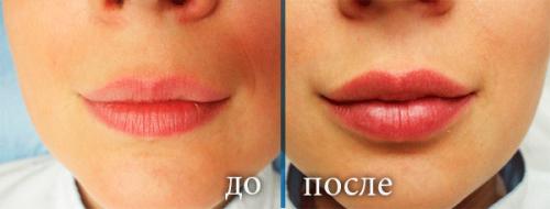 Акварельные губы сколько держатся. Что такое татуаж губ в акварельной технике? Фото до и после, отзывы, преимущества и недостатки