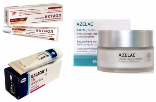 Фолликулит после Лазерной эпиляции лечение. Как снять воспаление после эпиляции