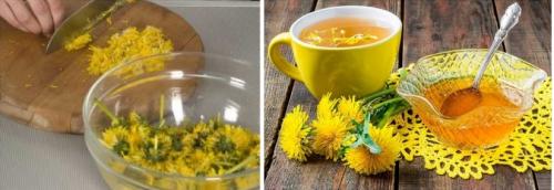 Фолликулит после Лазерной эпиляции лечение. Как снять воспаление после эпиляции