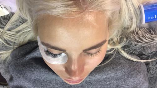 Веки опухли после наращивания. Что делать, если опухли веки после наращивания ресниц и нормально ли это? 02 Веки опухли после наращивания. Что делать, если опухли веки после наращивания ресниц и нормально ли это? 02