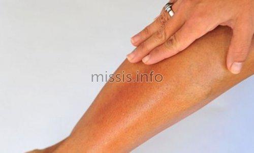 Последствия Лазерной эпиляции в зоне бикини. Что такое лазерная эпиляция зоны бикини? 04 Последствия Лазерной эпиляции в зоне бикини. Что такое лазерная эпиляция зоны бикини? 04