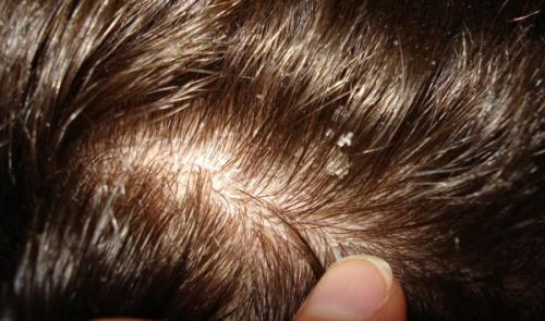 Как кератин влияет на окрашенные волосы. Навредит ли волосам окрашивание