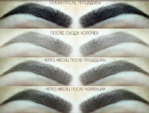 Заживление бровей после коррекции. Сколько заживают брови после татуажа?