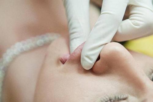 Больно ли губы делать. Разнообразие процедур по увеличению губ 03