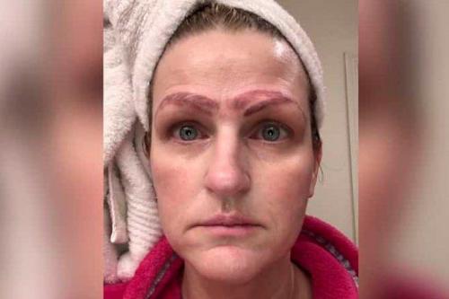 Микроблейдинг неудачный. Брови, на которые больно смотреть: горький опыт, после которого никто не захочет делать татуаж бровей