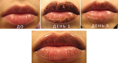 Татуаж губ заживление. Рекомендации профессионалов: