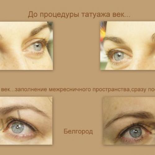 Межресничный татуаж, как делается. Что это 01