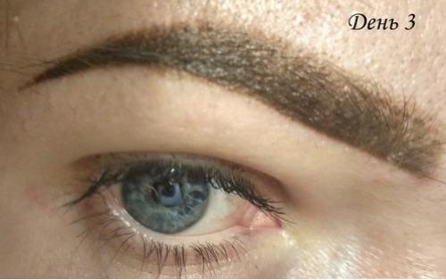 Пудровые брови заживление после коррекции. Третий день заживления пудрового татуажа: появление корочек