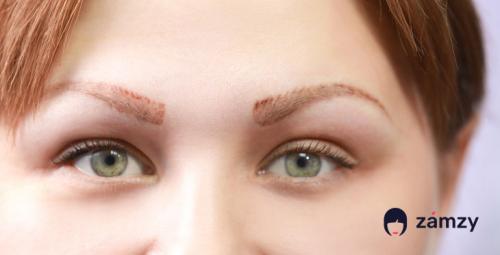 Сведение татуажа лазером. Удаление татуажа 02 Сведение татуажа лазером. Удаление татуажа 02