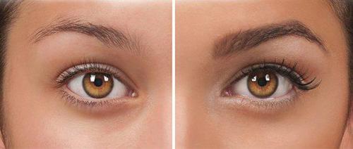 Чем ламинирование отличается от ботокса. Чем отличается ботокс от ламинирования 01 Чем ламинирование отличается от ботокса. Чем отличается ботокс от ламинирования 01