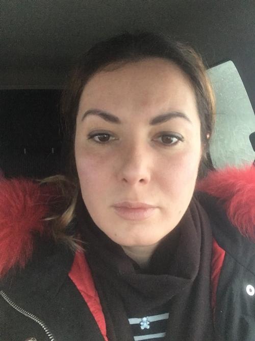 Удаление комков Биша последствия в старости. Удаление Комков Биша. мой опыт.