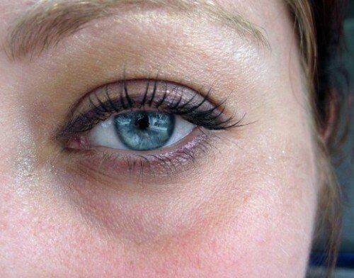 Как убрать желтые круги под глазами в домашних условиях. Желтые круги под глазами – в чем причина?