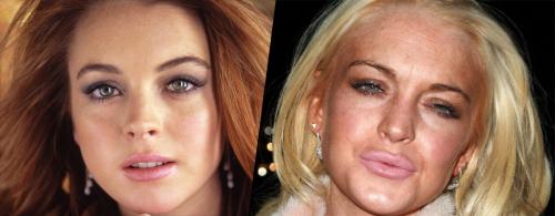 Почему девушки наращивают губы. 10 признаков того, что у вашей девушки «сделаны» губы