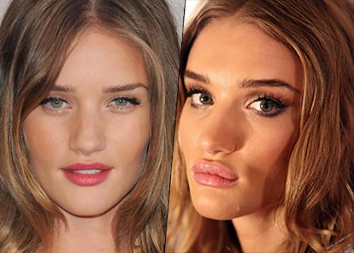 Почему девушки наращивают губы. 10 признаков того, что у вашей девушки «сделаны» губы