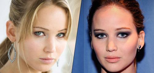 Почему девушки наращивают губы. 10 признаков того, что у вашей девушки «сделаны» губы