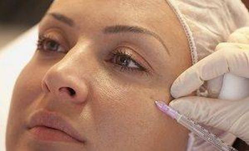 От кругов под глазами. Как убрать темные круги вокруг глаз в домашних условиях быстро, народные средства 06