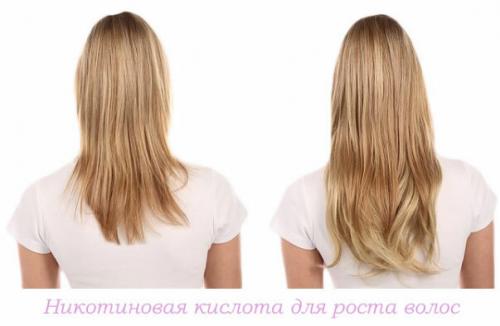 Как красиво отрастить волосы. Хитрость №1: Изучаем подшерсток