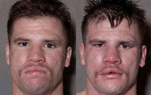 Список селфи на каждый день. Девушка делала селфи каждый день в течение 8 лет, и в конце она сильно изменилась