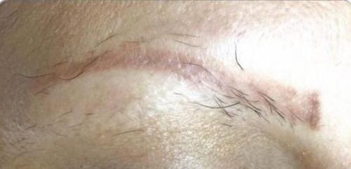 Микроблейдинг бровей неудачные работы. Теперь факты: 21 Микроблейдинг бровей неудачные работы. Теперь факты: 21