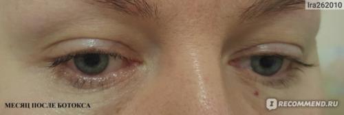Ботокс 3д для ресниц. Ботокс или вельвет?