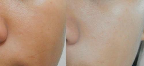 Отбеливающая маска в домашних условиях. Самые популярные ингредиенты масок, обладающие осветляющими качествами