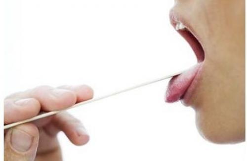 Диагностика заболеваний по языку. Состояние языка при заболеваниях пищеварительной системы 02