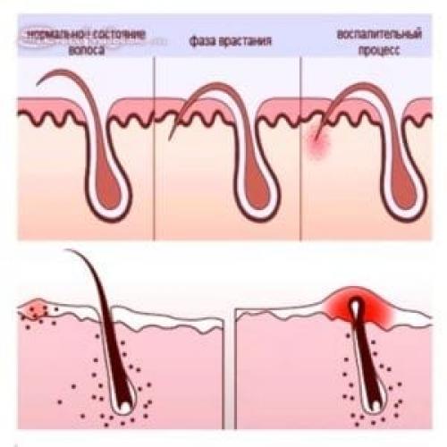 Чем заменить энзимную пудру в домашних условиях. Энзимная пудра – ферменты для очищения кожи