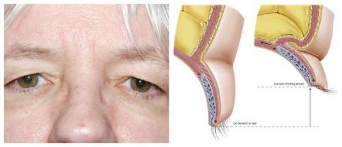 Жирные веки скатываются тени. Трюки: что делать, чтобы тени не скатывались на веках? 10