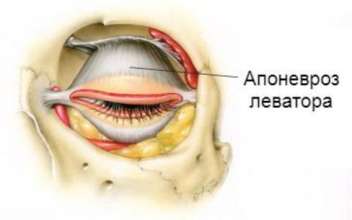 Что такое нависающее веко. Эндоскопическая подтяжка бровей или верхней трети лица 03 Что такое нависающее веко. Эндоскопическая подтяжка бровей или верхней трети лица 03