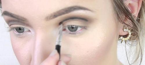 Что такое нависающее веко. Эндоскопическая подтяжка бровей или верхней трети лица 10 Что такое нависающее веко. Эндоскопическая подтяжка бровей или верхней трети лица 10